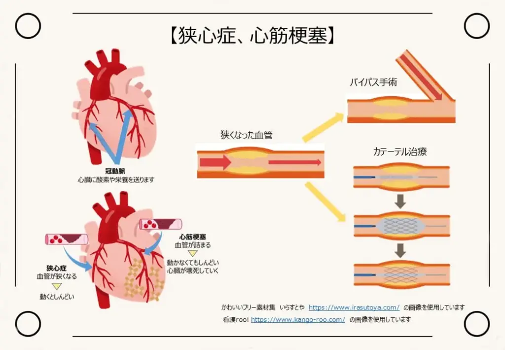 狭心症・心筋梗塞