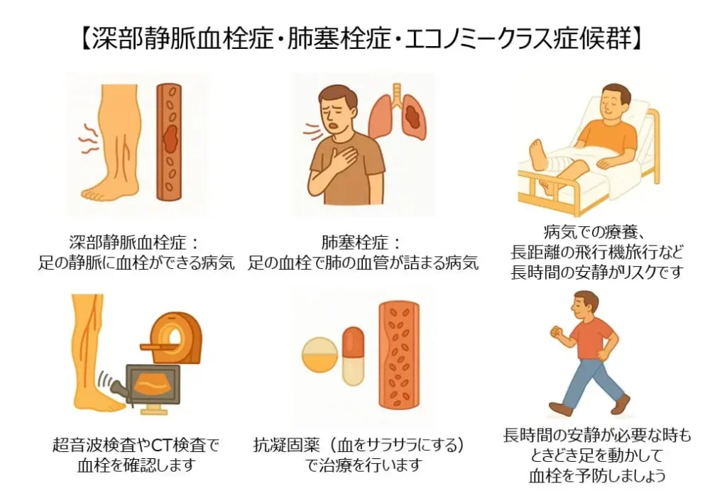 深部静脈血栓症・肺塞栓症
