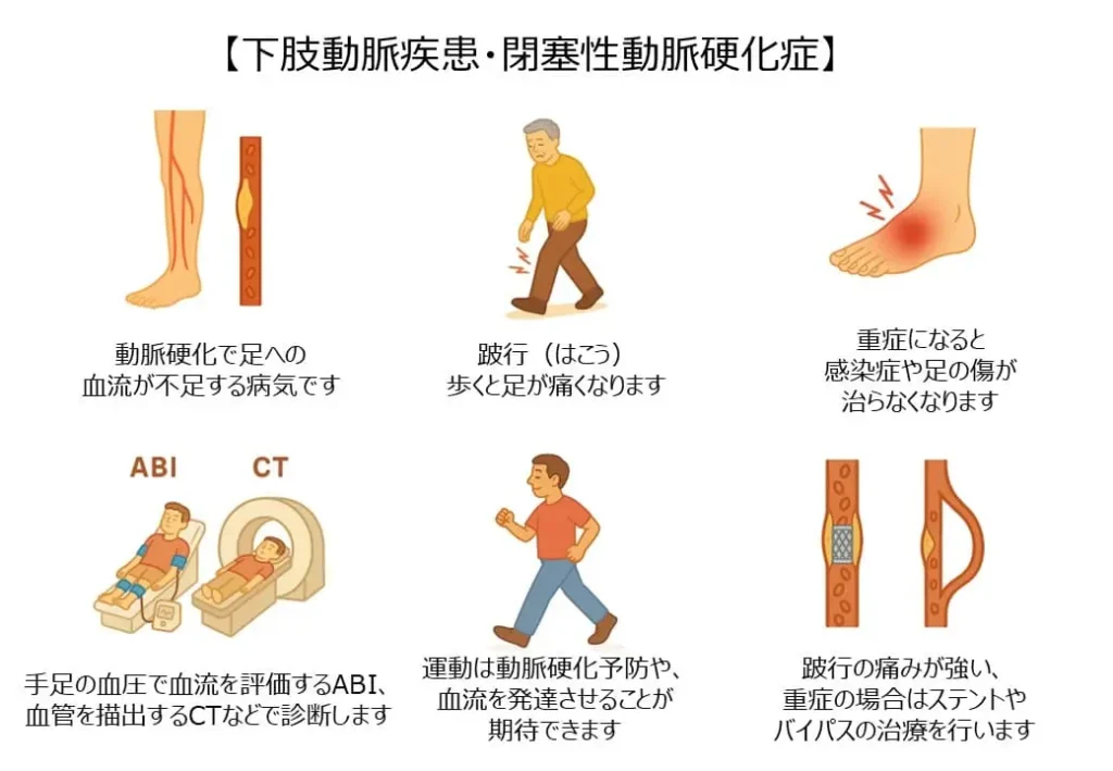 下肢動脈疾患